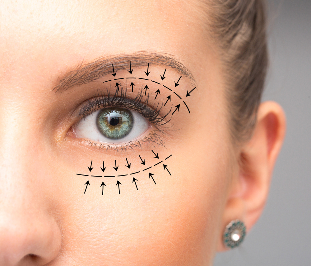 Blepharoplasty Techniques: Discovering Your Options | Georgia Plastic and Reconstructive Surgery
