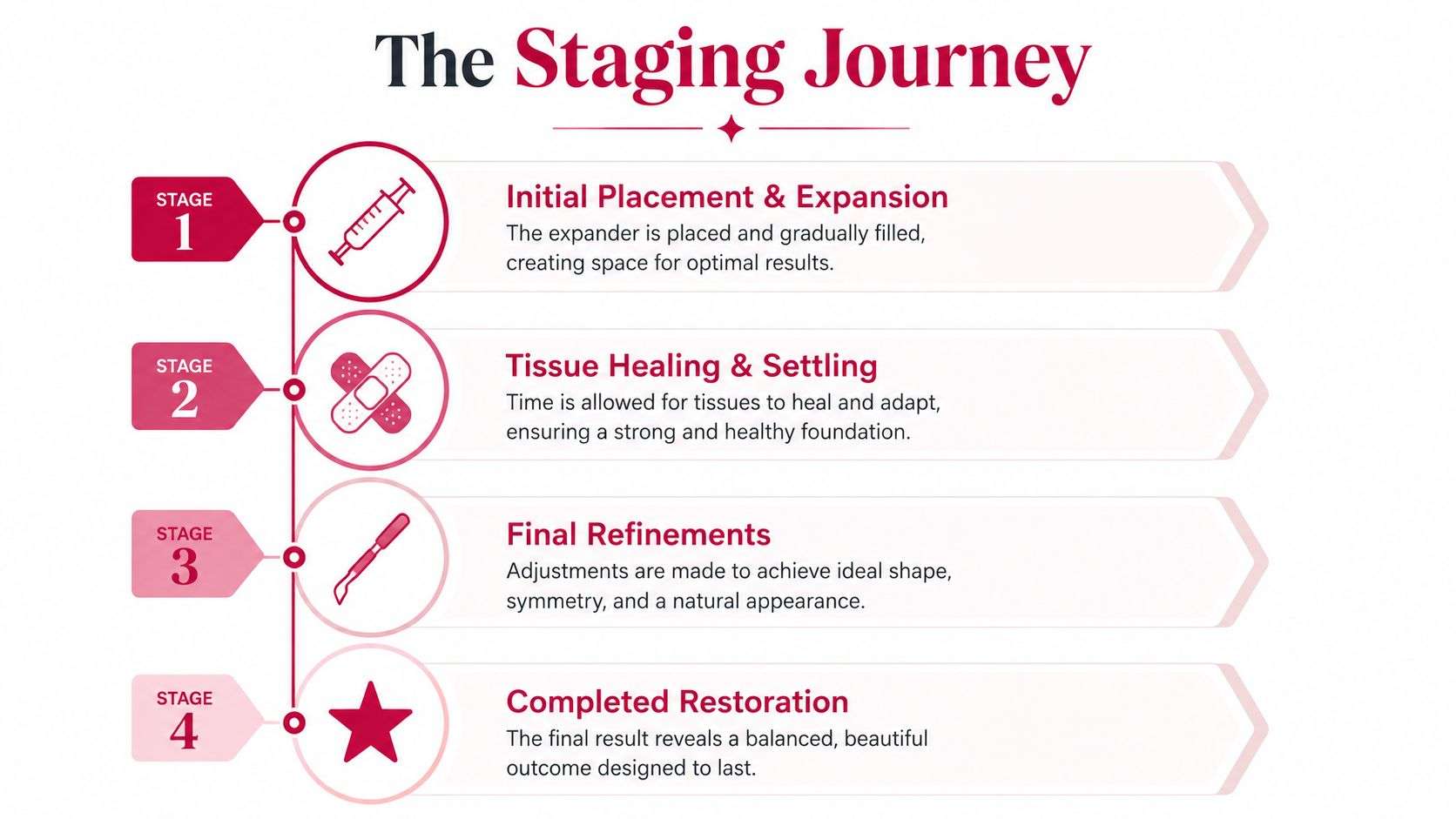 A flowchart infographic titled The Staging Journey describing the four stages of the breast reconstruction process.