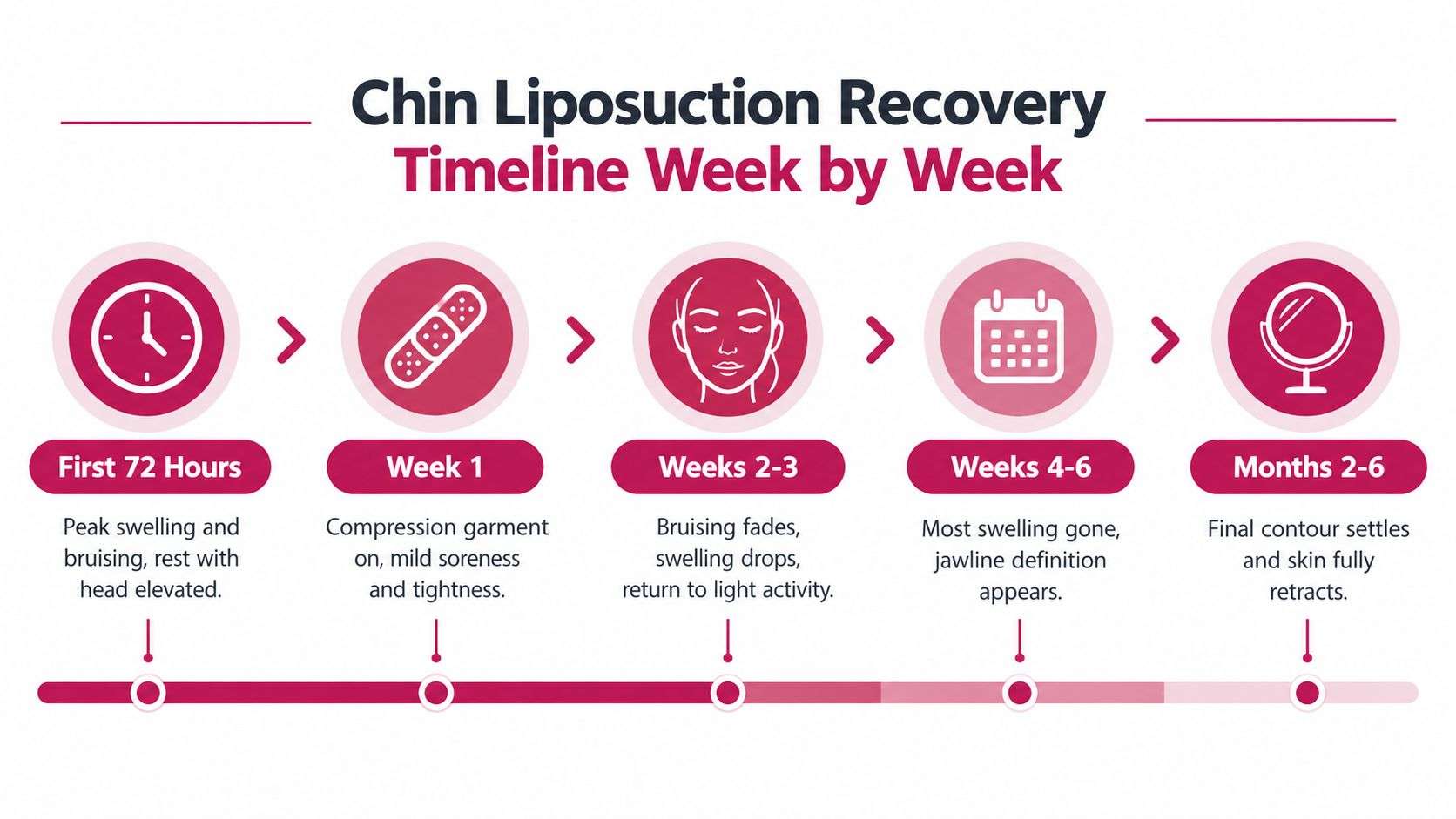 A timeline graphic illustrating the recovery stages and expected milestones after undergoing chin liposuction surgery.